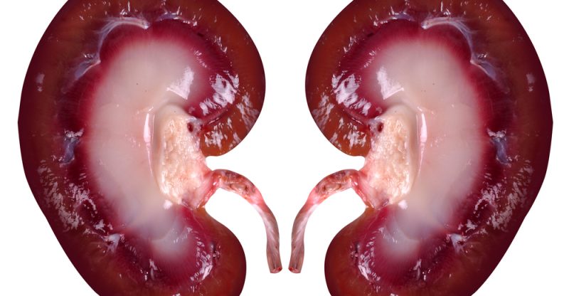 Kidneys in January 2019